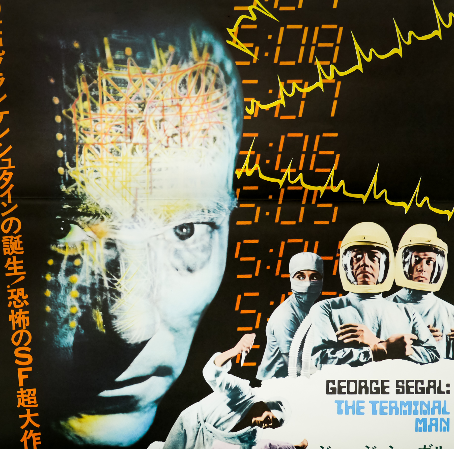 The Terminal Man Original 1974 Japanese B2 Movie Poster